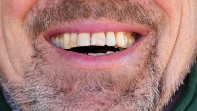 Könnte Lachen ein Therapieansatz werden? (Foto: Soeren Stache/dpa-Zentralbild/dpa)